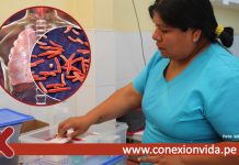 Establecimiento Penitenciario Callao optimiza tratamiento de tuberculosis MDR con menos medicación y recuperación acelerada